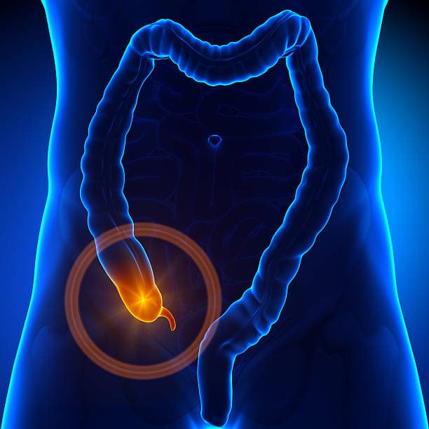 Appendicitis Pain Location Diagram
