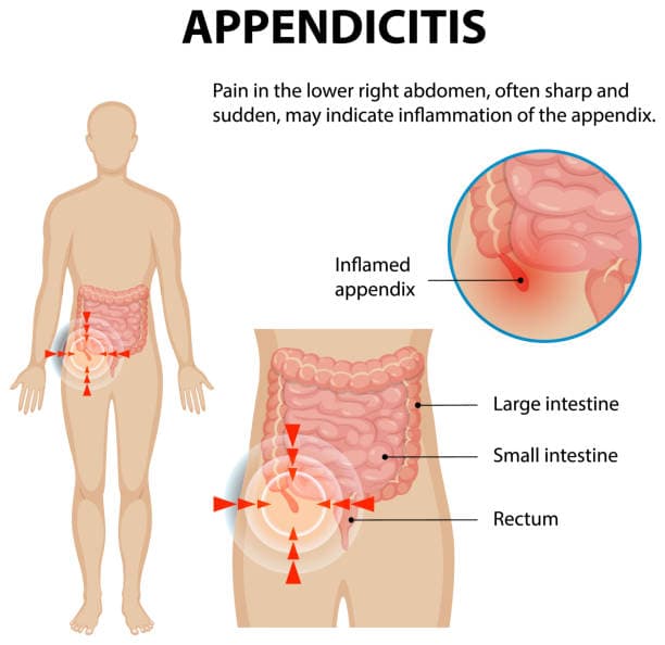 Hero image of abdominal pain comparison