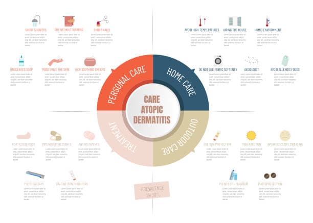 Infographic showing steps to apply moisturizer for eczema