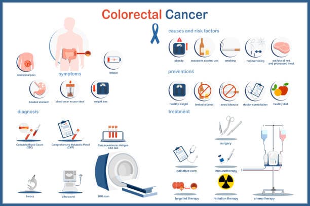 Colorectal Cancer Prevention Tips