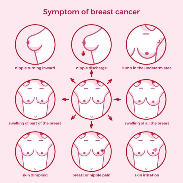 Breast Cancer Symptom Illustration
