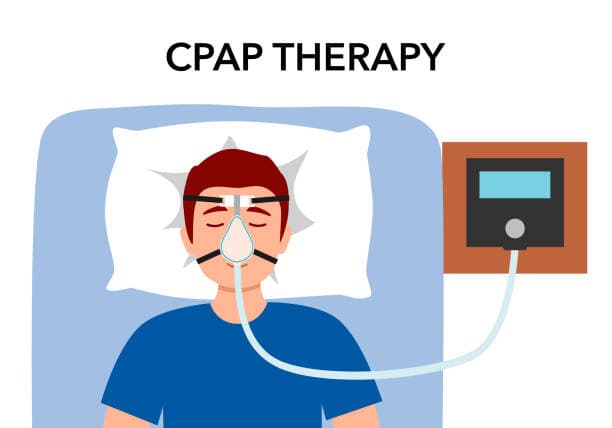 Benefits of CPAP Machine