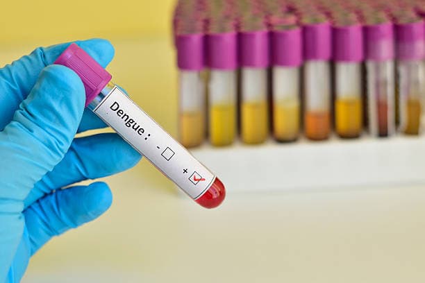 Dengue fever diagnosis process