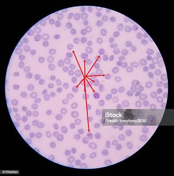 Healthy vs infected blood cells