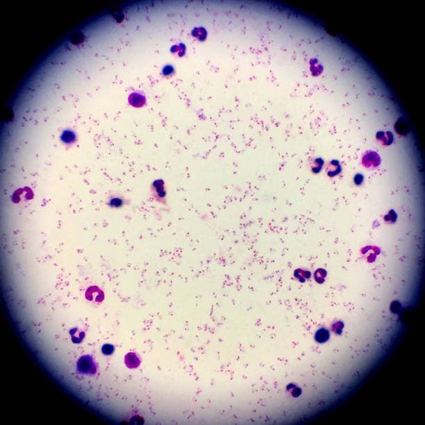 Malaria parasite under microscope