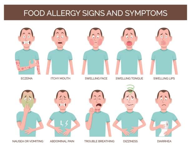 Eczema Diet Plan Infographic