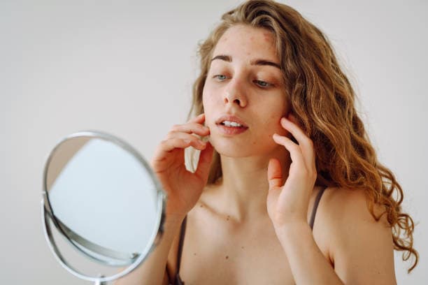 Facial Eczema Triggers