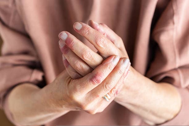 Eczema on Hands Triggers