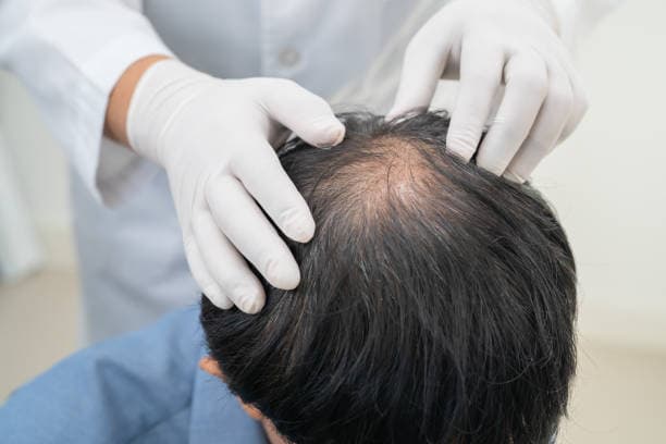 Doctor discussing thyroid test results