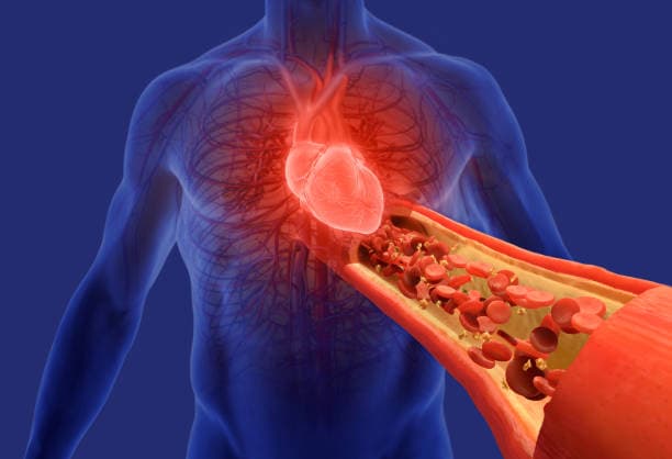 Hypertension Complications Overview