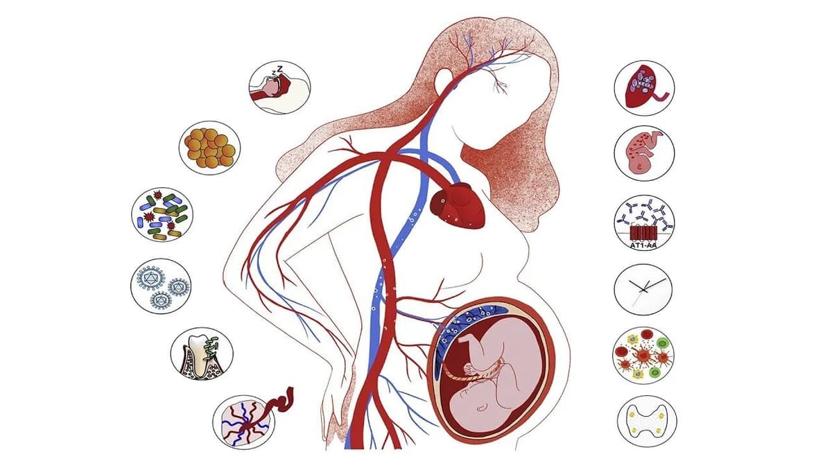 Image of Risk Factors Infographic