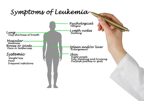 Common Leukemia Symptoms