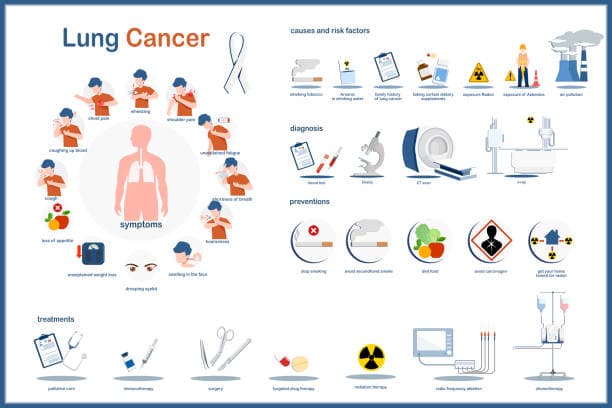 Risk factors for lung cancer