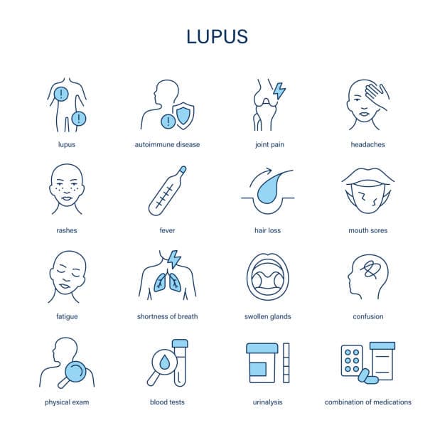 Lupus Fatigue Daily Life