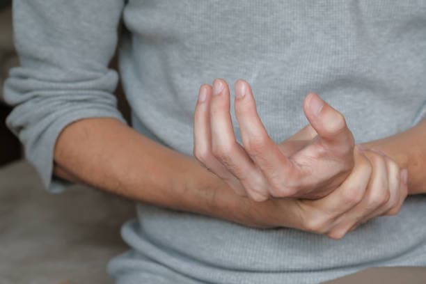 Unique Lupus Signs in Men