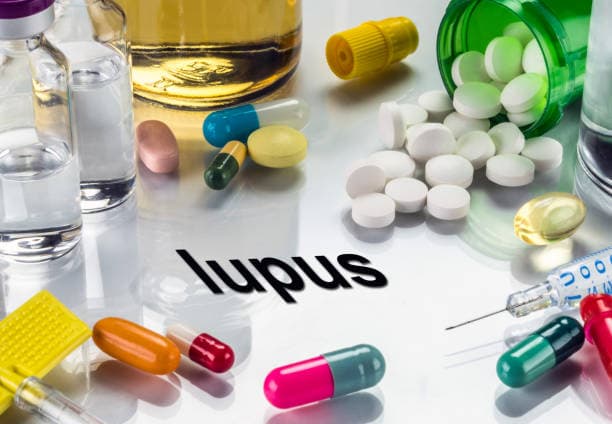 Treatment for lupus neurology