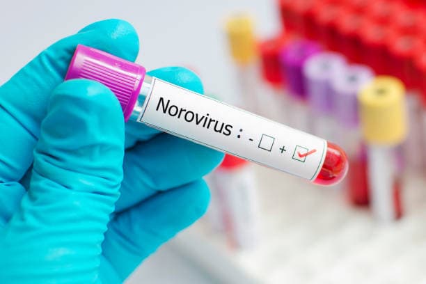 Norovirus Recovery Tips
