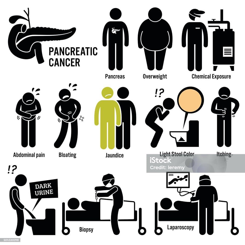Risk Factors of Pancreatic Cancer