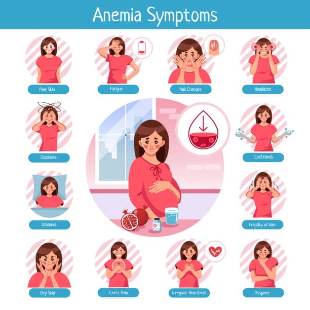 Symptoms of iron deficiency in pregnancy