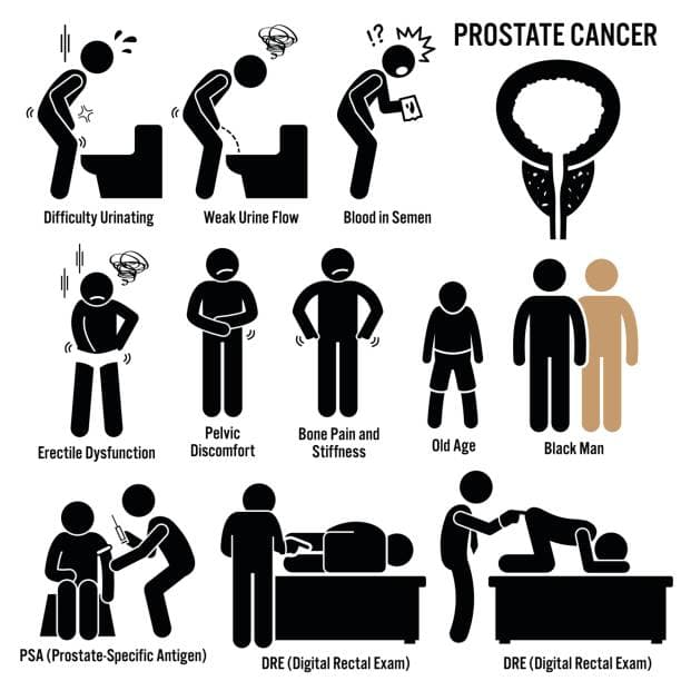 Early Signs of Prostate Cancer