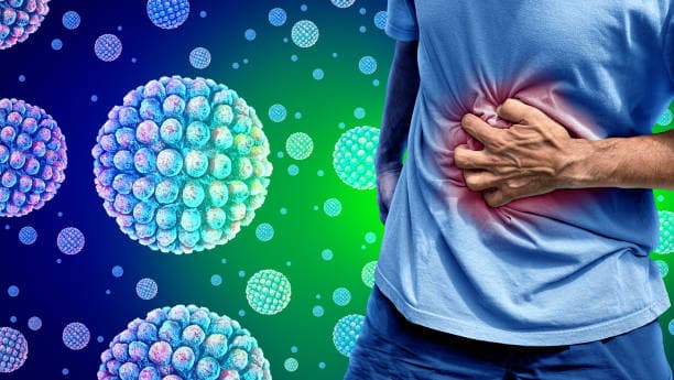 Illustration of severe norovirus symptoms including vomiting, dehydration, and stomach pain