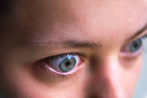 Thyroid Eye Disease Symptoms Illustration