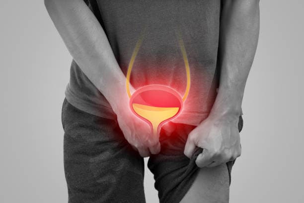 Risk factors infographic for UTI in men
