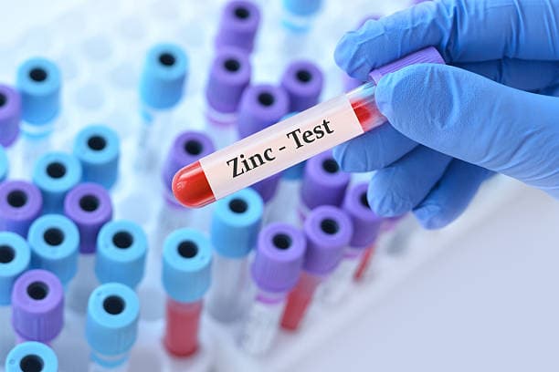 Zinc deficiency diagnosis